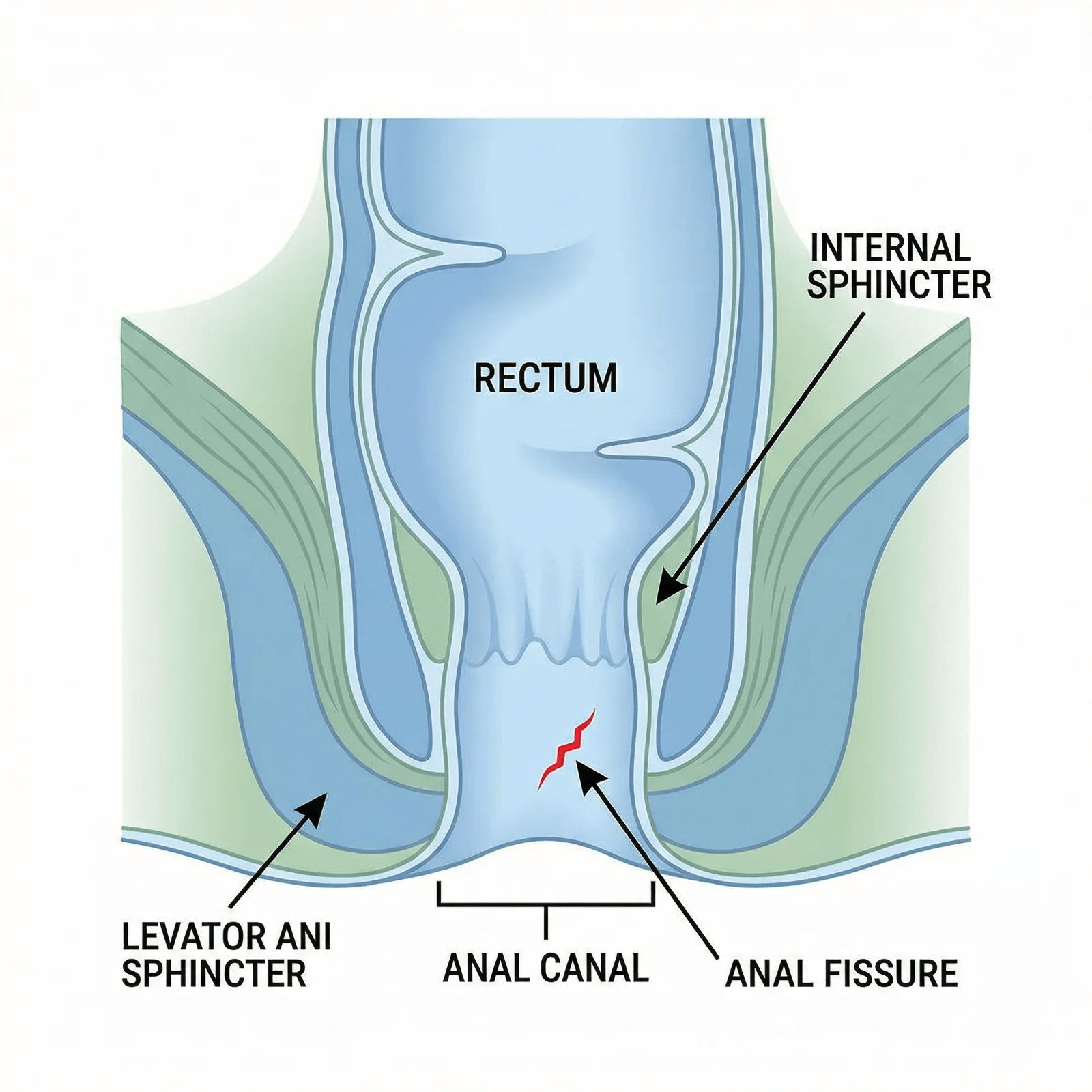 Anal-Fissure-Anatomy